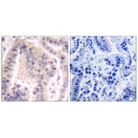 Immunohistochemistry - eIF4B (Ab-422) Antibody from Signalway Antibody (21513) - Antibodies.com