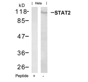 Western blot - STAT2 (Ab-690) Antibody from Signalway Antibody (21536) - Antibodies.com