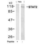 Western blot - STAT2 (Ab-690) Antibody from Signalway Antibody (21536) - Antibodies.com