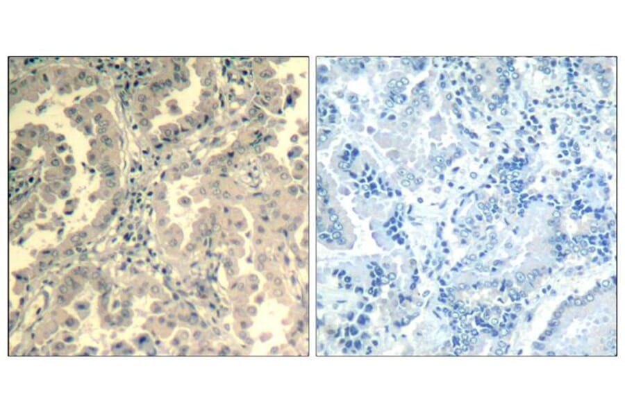 Immunohistochemistry - STAT2 (Ab-690) Antibody from Signalway Antibody (21536) - Antibodies.com