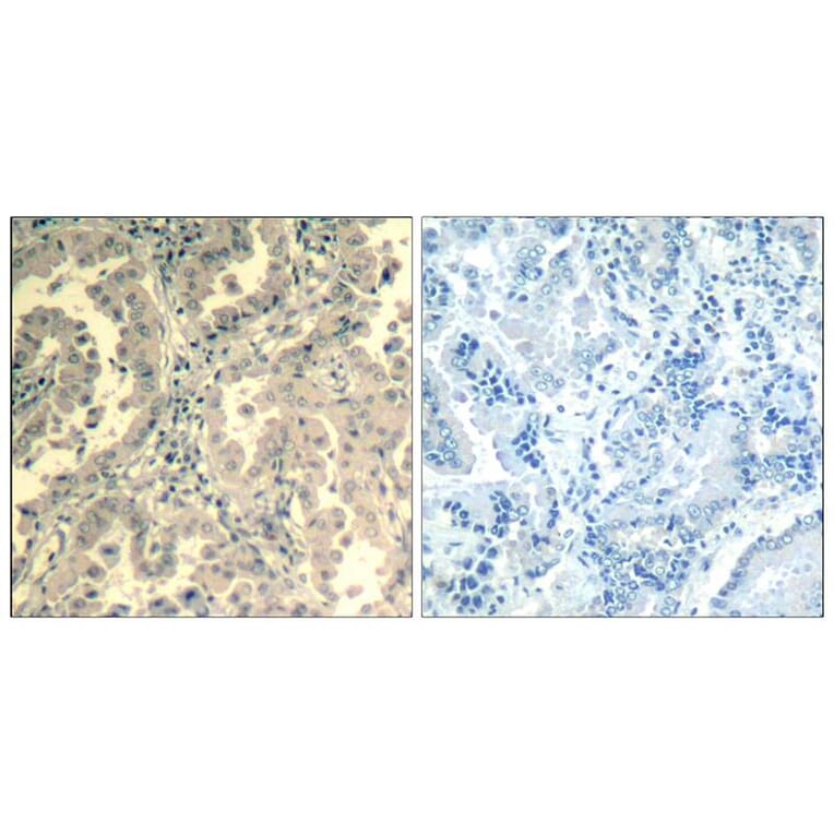 Immunohistochemistry - STAT2 (Ab-690) Antibody from Signalway Antibody (21536) - Antibodies.com
