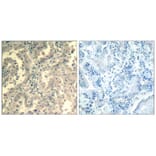 Immunohistochemistry - STAT2 (Ab-690) Antibody from Signalway Antibody (21536) - Antibodies.com