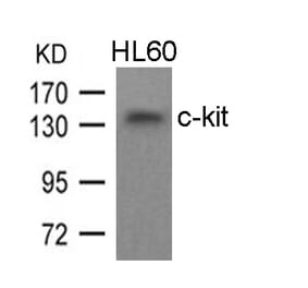 Western blot - c-kit (Ab-936) Antibody from Signalway Antibody (21539) - Antibodies.com