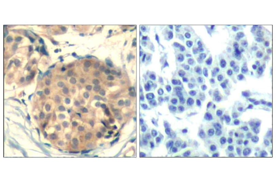 Immunohistochemistry - c-kit (Ab-936) Antibody from Signalway Antibody (21539) - Antibodies.com