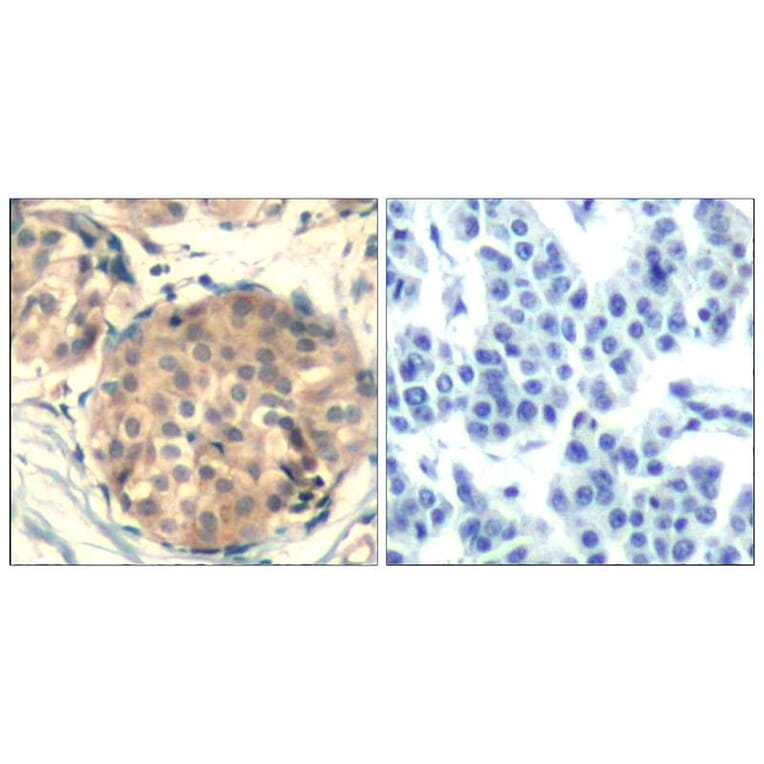 Immunohistochemistry - c-kit (Ab-936) Antibody from Signalway Antibody (21539) - Antibodies.com
