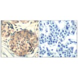 Immunohistochemistry - c-kit (Ab-936) Antibody from Signalway Antibody (21539) - Antibodies.com