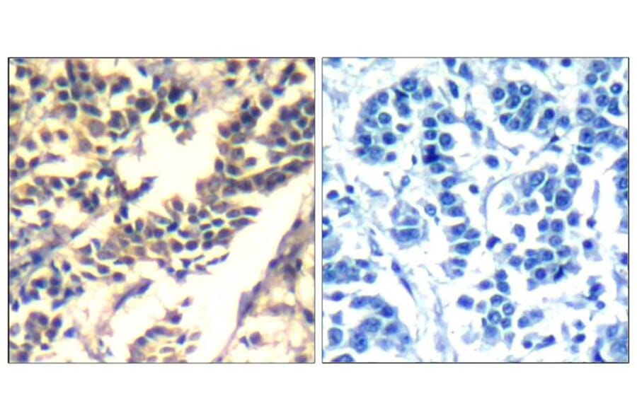 Immunohistochemistry - c-Cbl (Ab-700) Antibody from Signalway Antibody (21549) - Antibodies.com