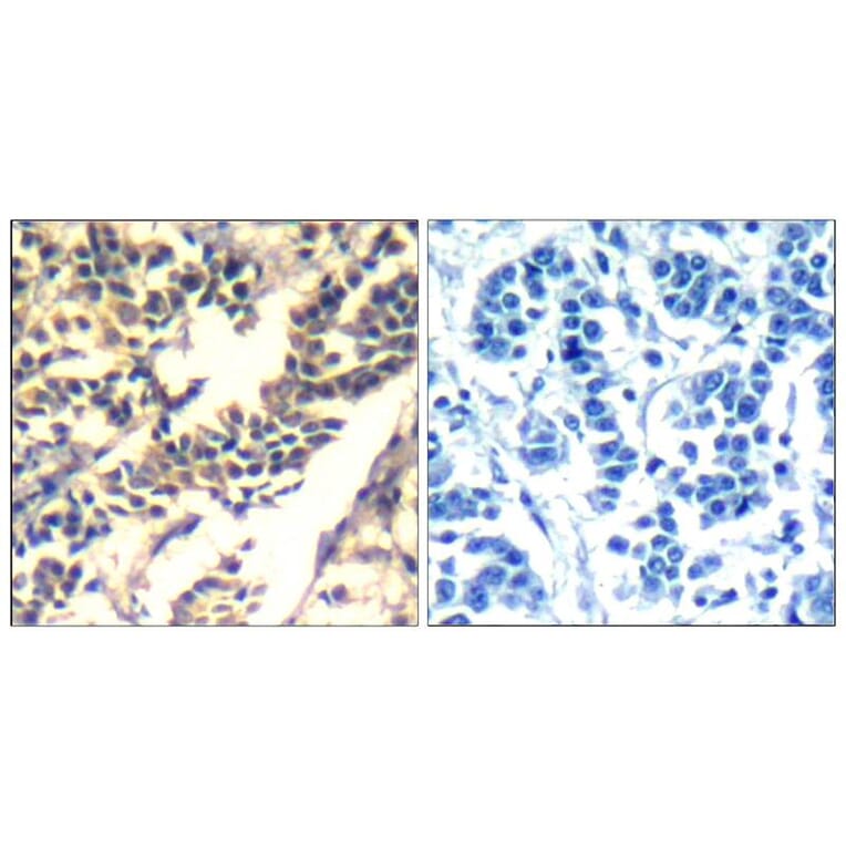 Immunohistochemistry - c-Cbl (Ab-700) Antibody from Signalway Antibody (21549) - Antibodies.com