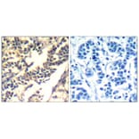 Immunohistochemistry - c-Cbl (Ab-700) Antibody from Signalway Antibody (21549) - Antibodies.com