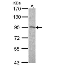 Desmocollin 2 antibody from Signalway Antibody (22014) - Antibodies.com