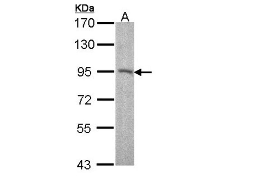Desmocollin 2 antibody from Signalway Antibody (22014) - Antibodies.com