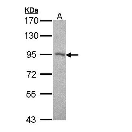 Desmocollin 2 antibody from Signalway Antibody (22014) - Antibodies.com