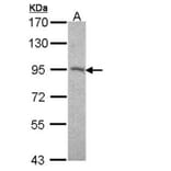 Desmocollin 2 antibody from Signalway Antibody (22014) - Antibodies.com