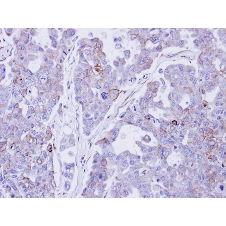 Immunohistochemistry - Desmocollin 2 antibody from Signalway Antibody (22014) - Antibodies.com