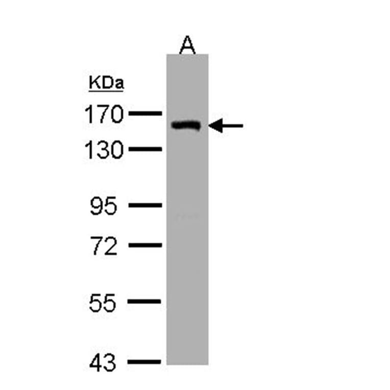 DKFZP686A01247 antibody from Signalway Antibody (22177) - Antibodies.com