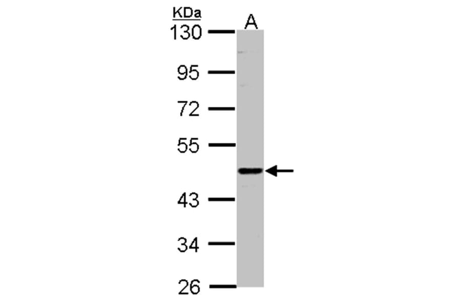 ENTPD6 (CD39L2) antibody from Signalway Antibody (22362) - Antibodies.com