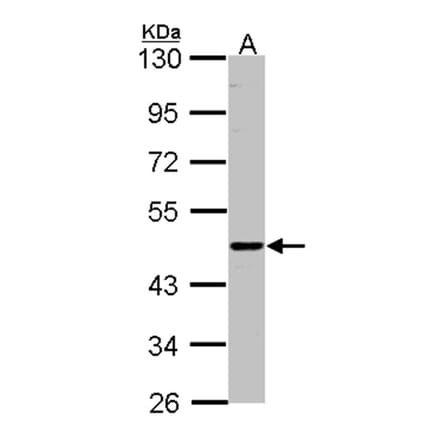 ENTPD6 (CD39L2) antibody from Signalway Antibody (22362) - Antibodies.com