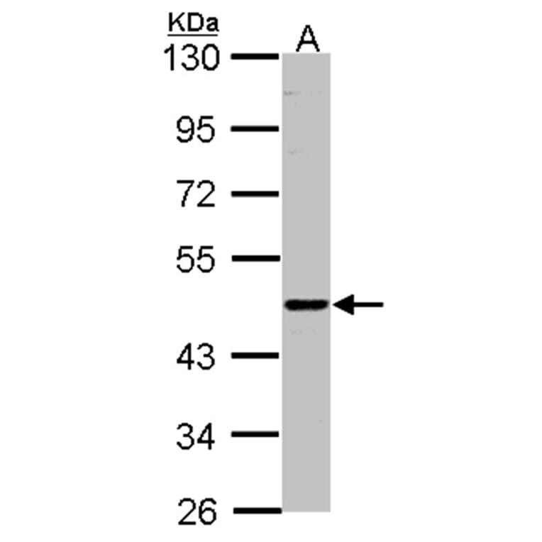 ENTPD6 (CD39L2) antibody from Signalway Antibody (22362) - Antibodies.com