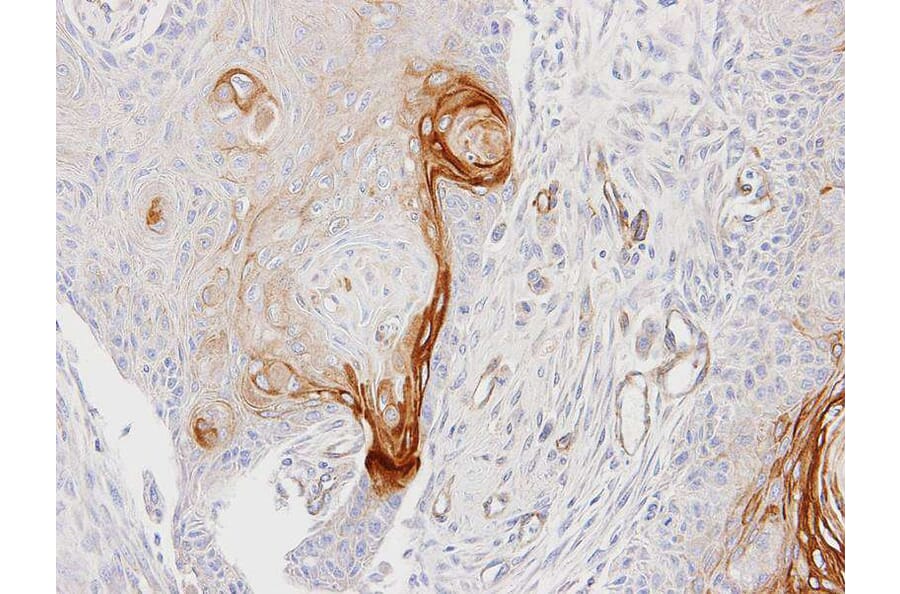 Immunohistochemistry - ENTPD6 (CD39L2) antibody from Signalway Antibody (22362) - Antibodies.com