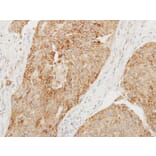 Immunohistochemistry - Chromogranin C antibody from Signalway Antibody (22573) - Antibodies.com