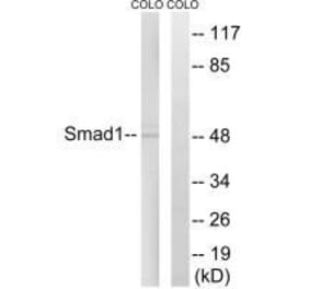 Western blot - Smad1 (Ab-465) Antibody from Signalway Antibody (33118) - Antibodies.com