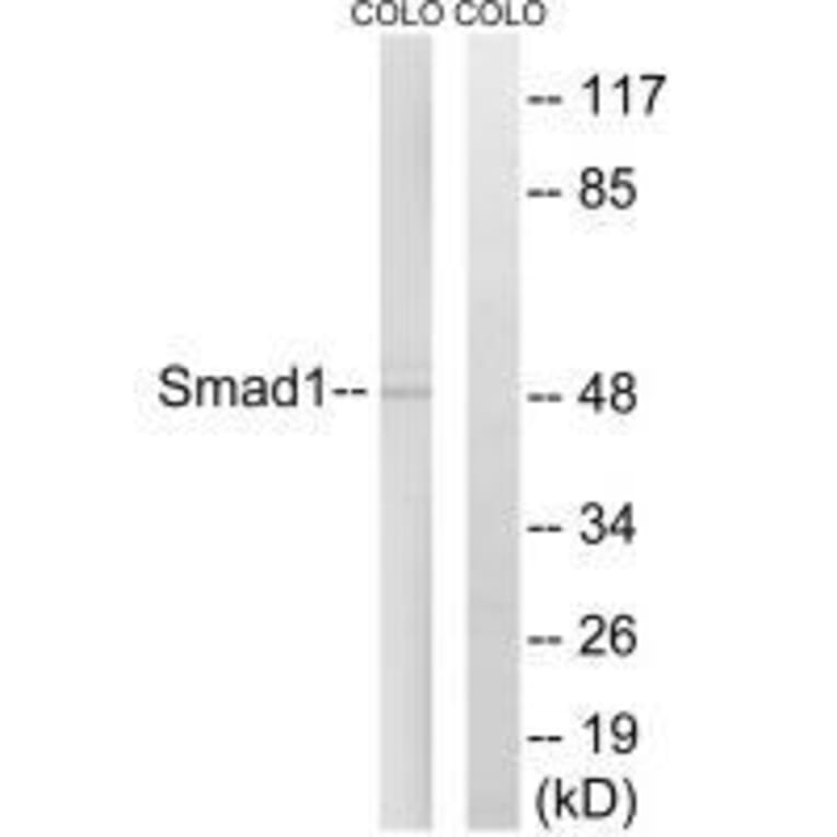 Western blot - Smad1 (Ab-465) Antibody from Signalway Antibody (33118) - Antibodies.com