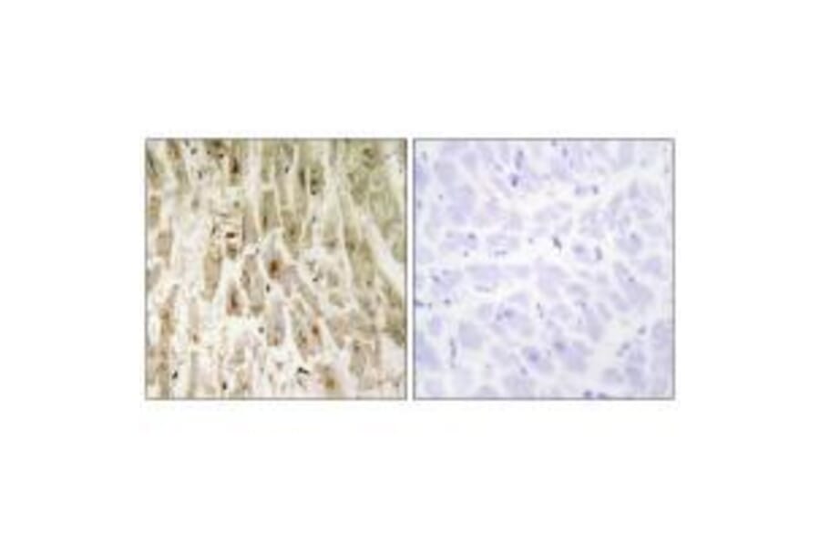 Immunohistochemistry - Smad1 (Ab-465) Antibody from Signalway Antibody (33118) - Antibodies.com