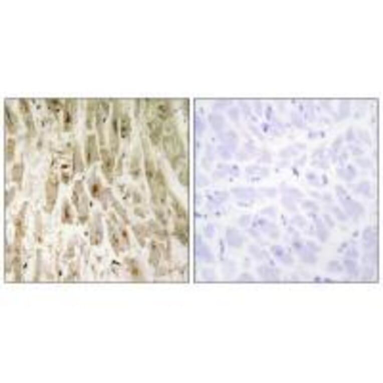Immunohistochemistry - Smad1 (Ab-465) Antibody from Signalway Antibody (33118) - Antibodies.com