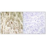 Immunohistochemistry - Smad1 (Ab-465) Antibody from Signalway Antibody (33118) - Antibodies.com