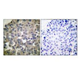 Immunohistochemistry - PLCG1 (Ab-771) Antibody from Signalway Antibody (33125) - Antibodies.com
