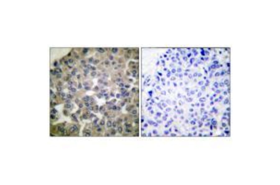 Immunohistochemistry - PLCG1 (Ab-771) Antibody from Signalway Antibody (33125) - Antibodies.com
