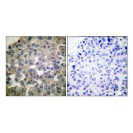 Immunohistochemistry - PLCG1 (Ab-771) Antibody from Signalway Antibody (33125) - Antibodies.com