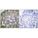 Immunohistochemistry - PLCG1 (Ab-771) Antibody from Signalway Antibody (33125) - Antibodies.com
