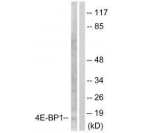 Western blot - 4E-BP1 (Ab-64) Antibody from Signalway Antibody (33127) - Antibodies.com