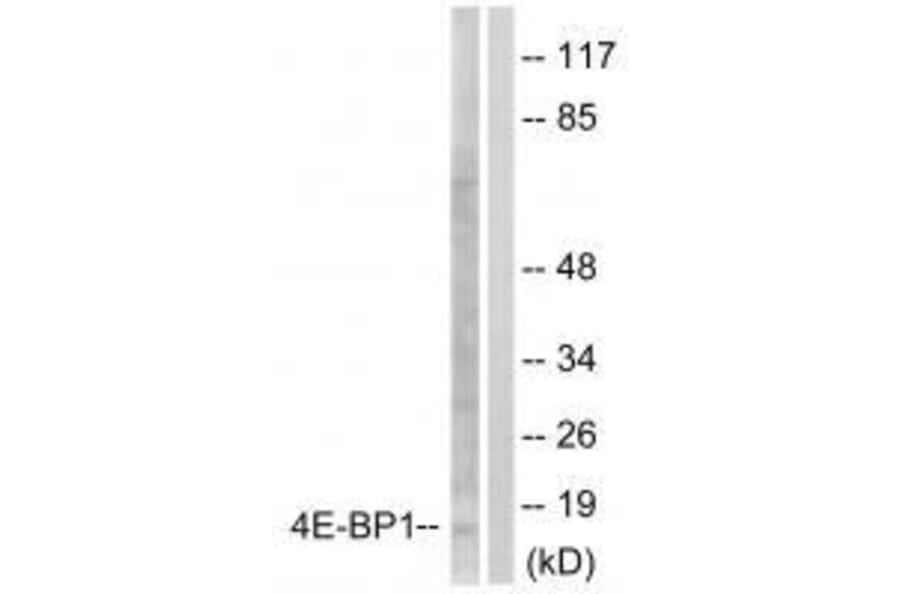 Western blot - 4E-BP1 (Ab-64) Antibody from Signalway Antibody (33127) - Antibodies.com