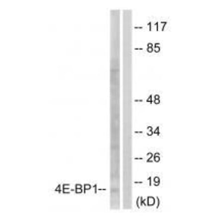 Western blot - 4E-BP1 (Ab-64) Antibody from Signalway Antibody (33127) - Antibodies.com