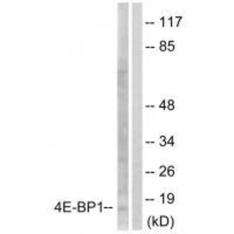 Western blot - 4E-BP1 (Ab-64) Antibody from Signalway Antibody (33127) - Antibodies.com