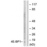 Western blot - 4E-BP1 (Ab-64) Antibody from Signalway Antibody (33127) - Antibodies.com