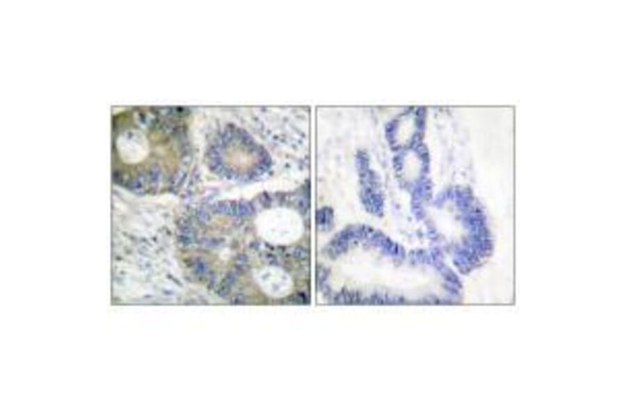 Immunohistochemistry - 4E-BP1 (Ab-64) Antibody from Signalway Antibody (33127) - Antibodies.com
