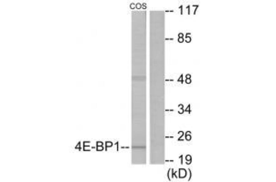 Western blot - 4E-BP1 (Ab-69) Antibody from Signalway Antibody (33128) - Antibodies.com