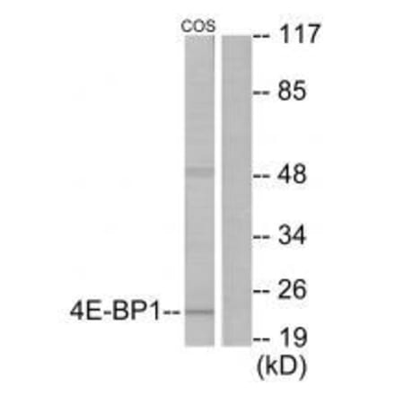 Western blot - 4E-BP1 (Ab-69) Antibody from Signalway Antibody (33128) - Antibodies.com