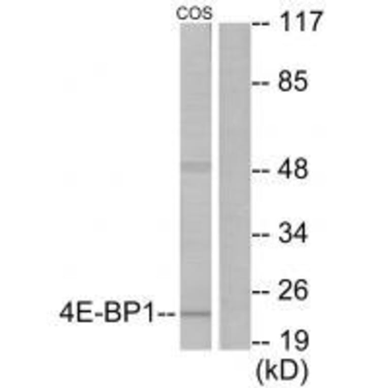 Western blot - 4E-BP1 (Ab-69) Antibody from Signalway Antibody (33128) - Antibodies.com