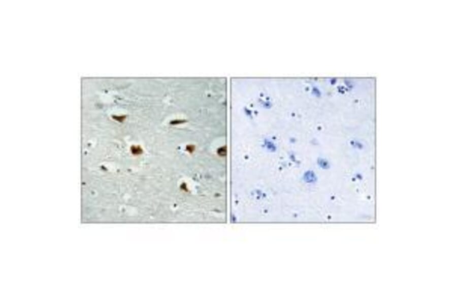 Immunohistochemistry - 4E-BP1 (Ab-69) Antibody from Signalway Antibody (33128) - Antibodies.com