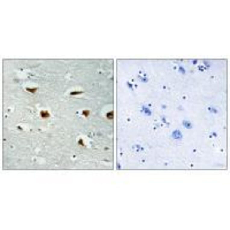 Immunohistochemistry - 4E-BP1 (Ab-69) Antibody from Signalway Antibody (33128) - Antibodies.com