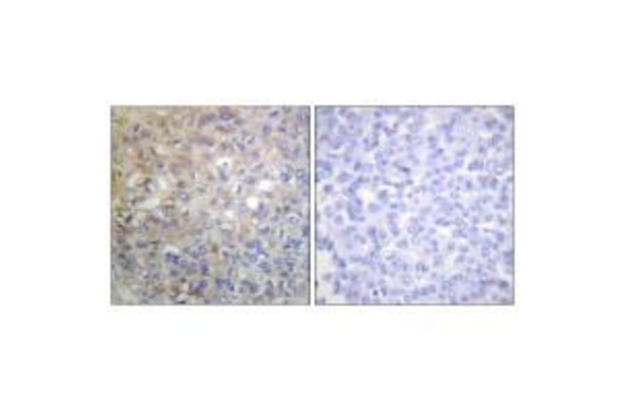 Immunohistochemistry - FGFR1 (Ab-766) Antibody from Signalway Antibody (33134) - Antibodies.com
