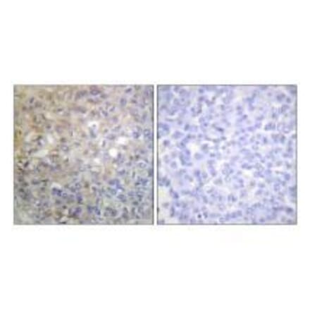 Immunohistochemistry - FGFR1 (Ab-766) Antibody from Signalway Antibody (33134) - Antibodies.com