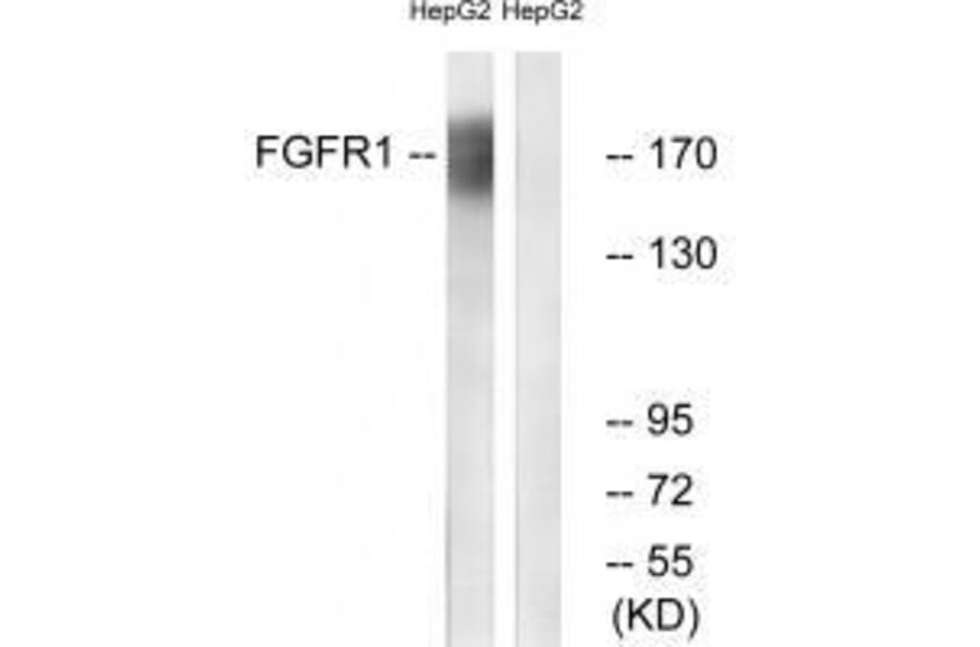 Western blot - FGFR1 (Ab-766) Antibody from Signalway Antibody (33134) - Antibodies.com