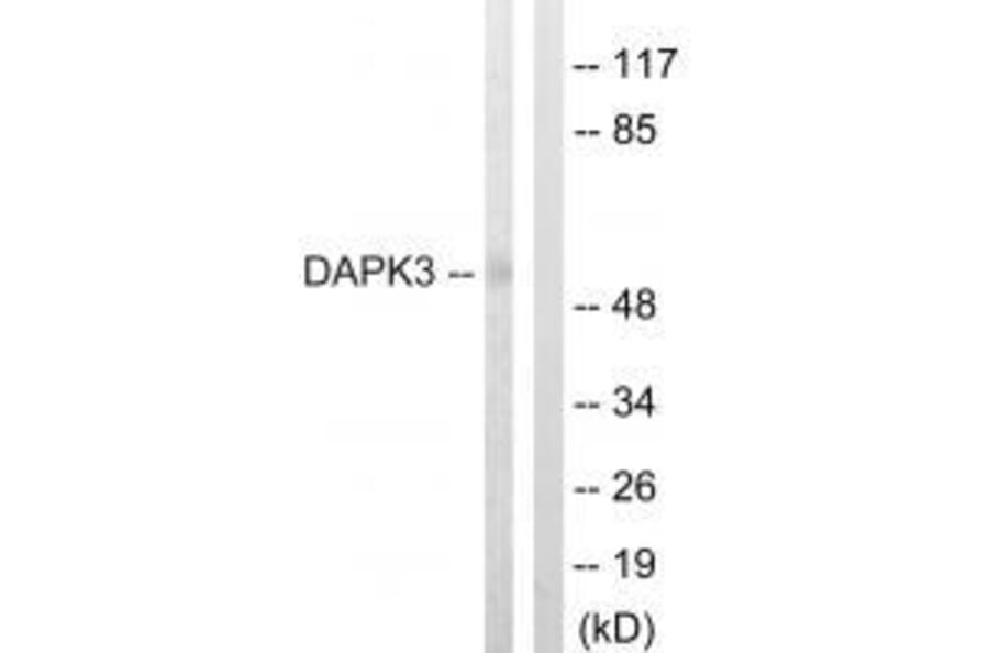 Western blot - DAPK3 (Ab-265) Antibody from Signalway Antibody (33158) - Antibodies.com