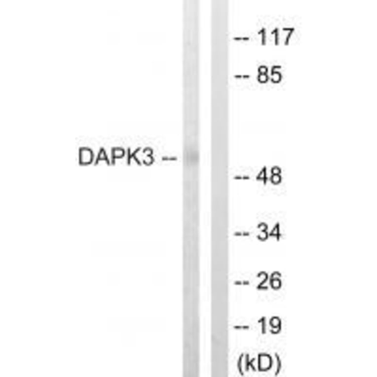 Western blot - DAPK3 (Ab-265) Antibody from Signalway Antibody (33158) - Antibodies.com