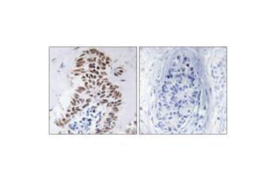 Immunohistochemistry - DAPK3 (Ab-265) Antibody from Signalway Antibody (33158) - Antibodies.com